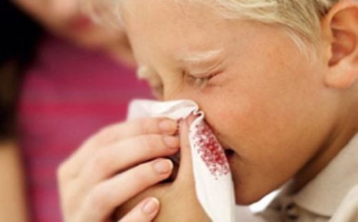 Şeffaf Burun Akıntısı Belirtileri ve Tedavisi